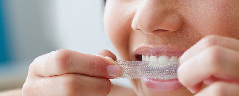 teeth whitening